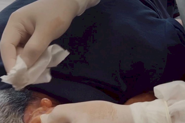 PREFEITURA DE TRINDADE INICIA REALIZAÇÃO DE PEQUENAS CIRURGIAS EM UNIDADES BÁSICAS DE SAÚDE